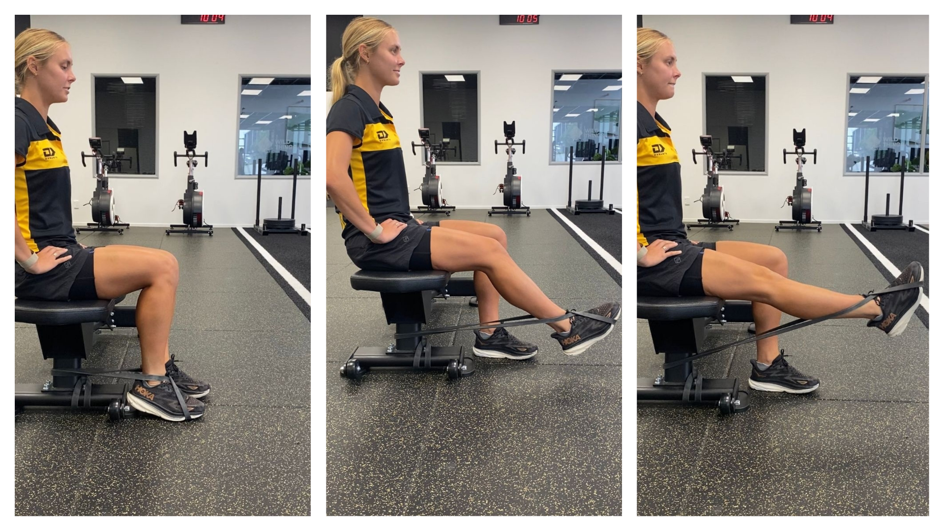Knee Extension Acl Rehab At Sarah Solomon Blog